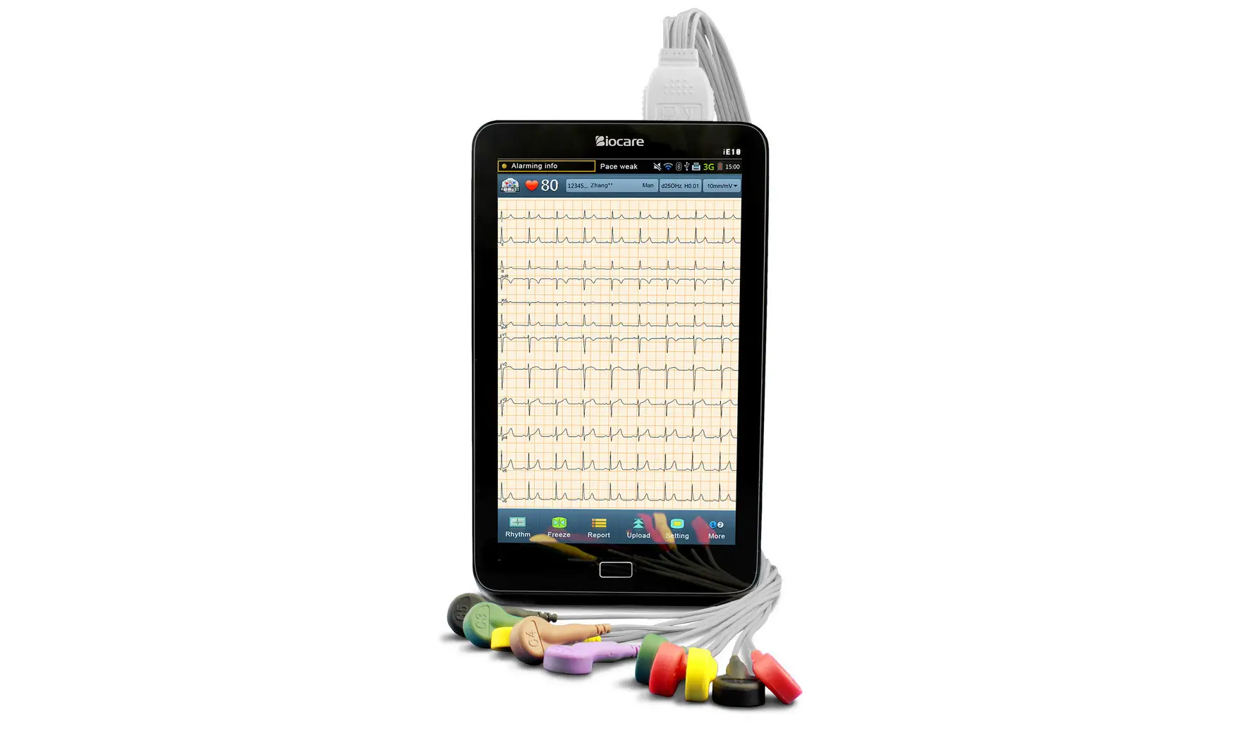 ELECTROCARDIOGRAPHE ECG PORTABLE